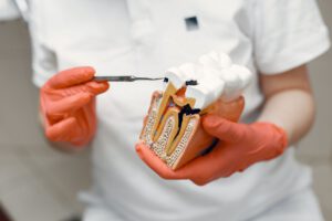 Choroby zębów i przyzębia