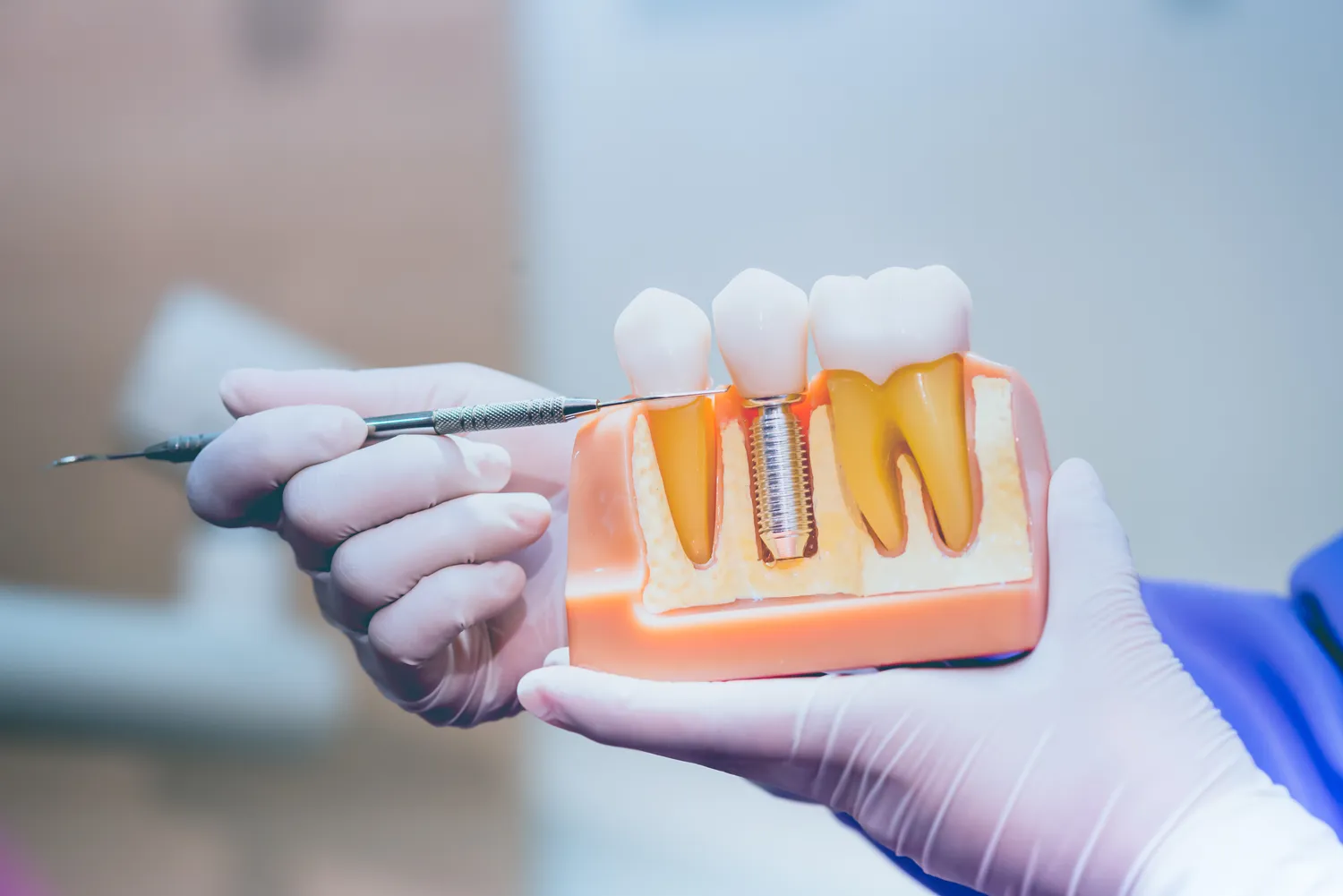 Endodoncja stomatologiczna Szczecin
